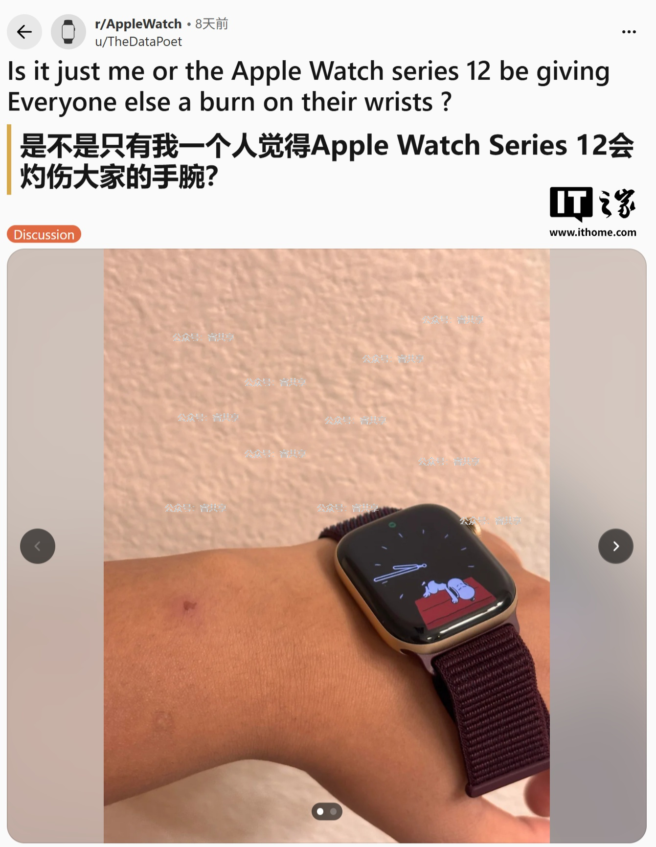 Apple Watch Series 12 用户报告皮肤刺激